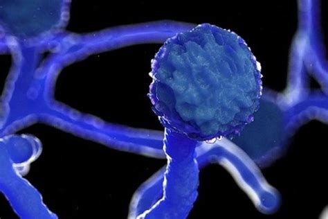 Don't panic by colour of fungus, look for causes, risks: Experts advise ...