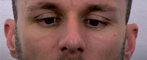 Image result for Trochlear Function