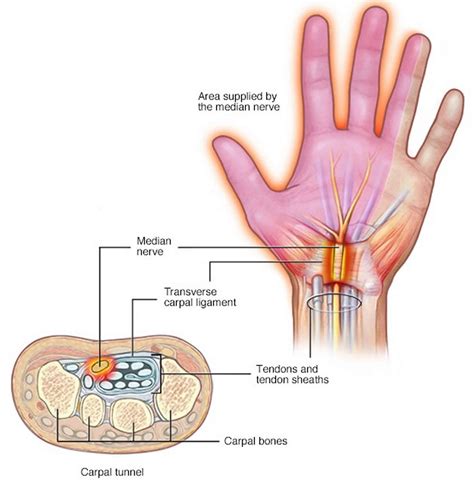 Nerve compression causes, symptoms, diagnosis & treatment