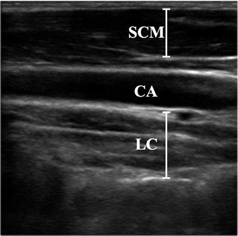 Promoting longus colli muscle activation: Force direction in sitting matters - Musculoskeletal ...