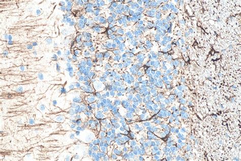 IHCeasy GFAP Ready-To-Use IHC Kit KHC0002 | Proteintech
