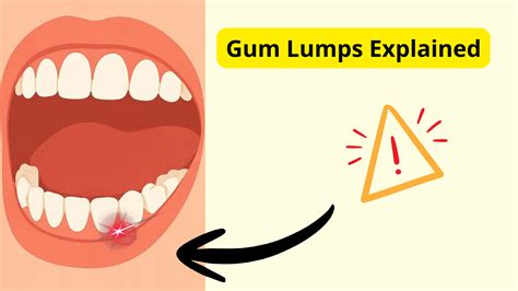 A Lump or Bump on Your Gum? Here’s What It Could Mean (Pictures)