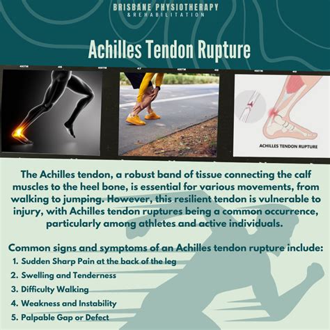 Achilles Tendon Rupture Achilles Tendon Tear Or Rupture | Ankle