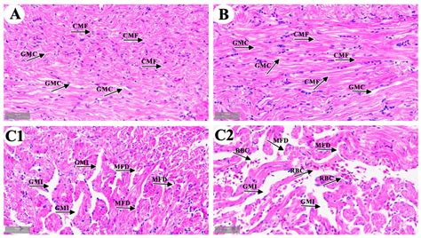 Oxidative Stress, Energy Metabolism Disorder, Mitochondrial Damage, and ...