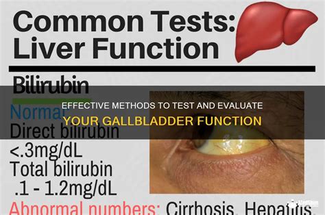 Image result for Gallbladder Test