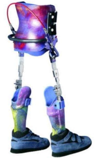 Reciprocating Gait Orthosis Manufacturers and Suppliers from Surat