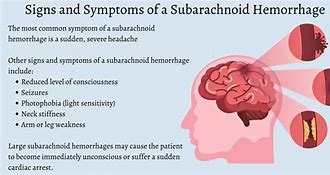 Image result for Subarachnoid