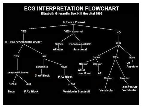 Image result for EKG Algorithm
