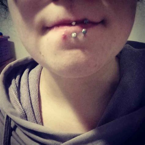 Piercing Rejection: What Does It Mean When a Piercing Rejects?