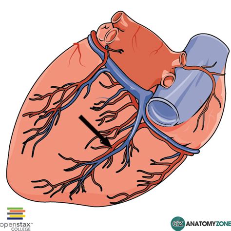 Posterior Interventricular (Descending) Artery - AnatomyZone