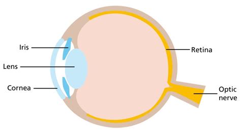 Image result for Colour Vision Deficiency Causes