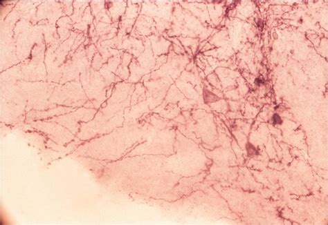 Substance P Receptor antibody Immunohistochemistry, Western S8305 Anti-SPR