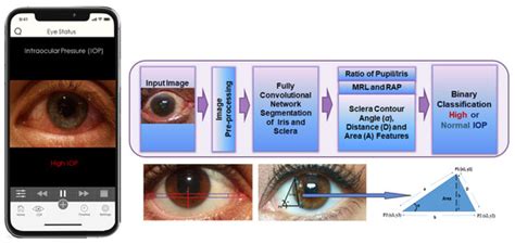 Eye-SCOR: A Supply Chain Operations Reference-Based Framework for Smart ...