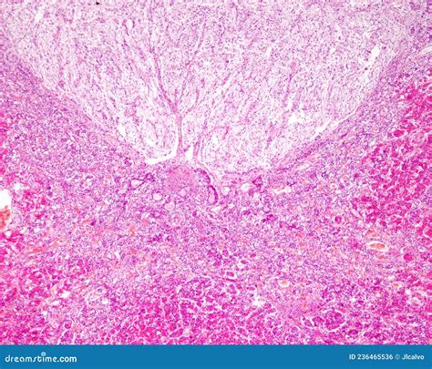Pituitary Gland. Pars Intermedia Stock Photo - Image of anatomical, intermedia: 236465536