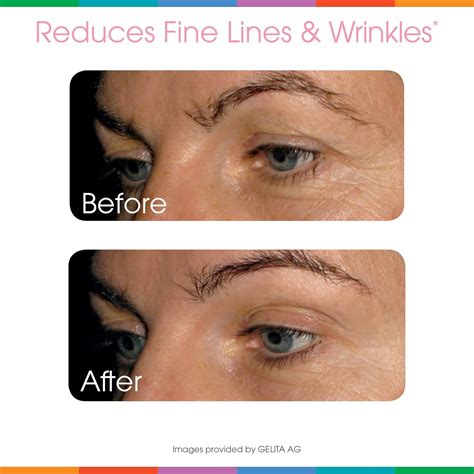 Buy Sparkle Skin Boost Acai Lemonade Verisol Collagen Peptides Protein ...