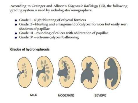 Image result for Nephrohydrosis Algorithm