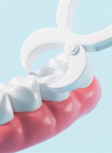 Image result for Healing Process of Tooth Extraction