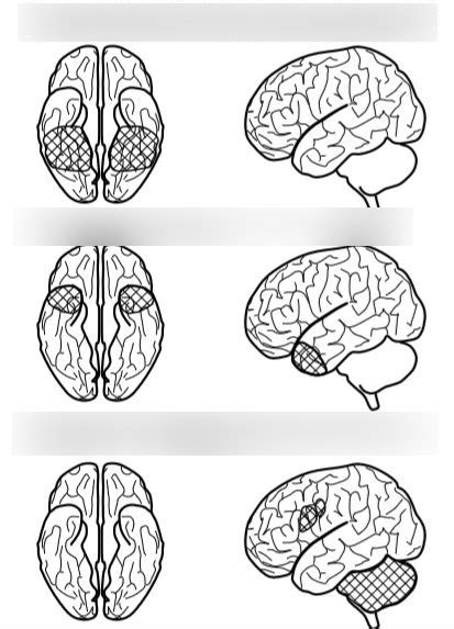 Brain Memory 的图像结果