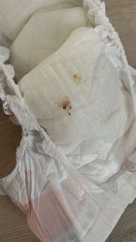 Diaper blood signs | BabyCenter