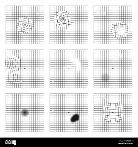 Amsler eye test grid. Oculist Vector printable chart retina examination ...