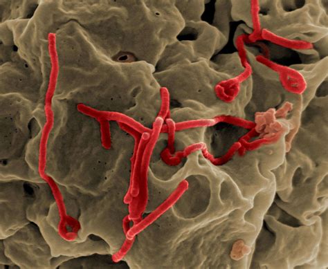 Ebola Virus | Encyclopedia MDPI