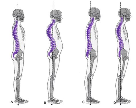 Lower Back Alignment 的图像结果