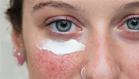 For proper skin care you should follow these 6 steps before going to bed