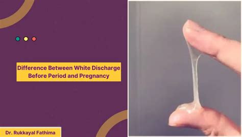 Discharge During Pregnancy