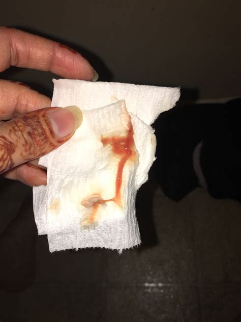 Bloody Vaginal Discharge Drost Project: The Visual Guide To Bovine