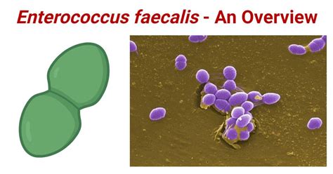 Image result for Enterococcus Faecalis Treatment Options