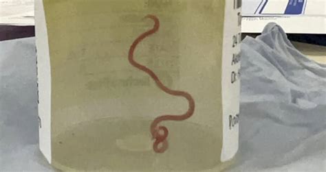 Image result for Memory Worm