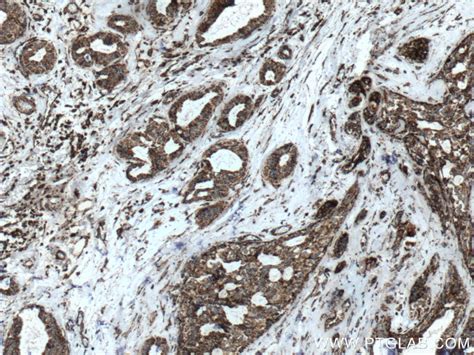SOD2 antibody (24127-1-AP) | Proteintech
