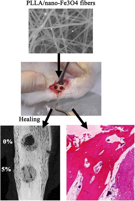 In Vivo Investigation into Effectiveness of Fe3O4/PLLA Nanofibers for ...