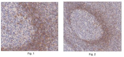 Anti-BTLA/cd272 Antibody, clone FLO67B | MABF269