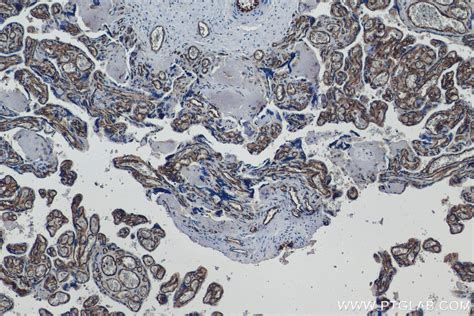 CD34 antibody (60180-1-Ig) | Proteintech