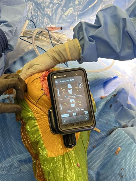 Lantern Surgical Assistant — Intelligent, handheld navigation for ...