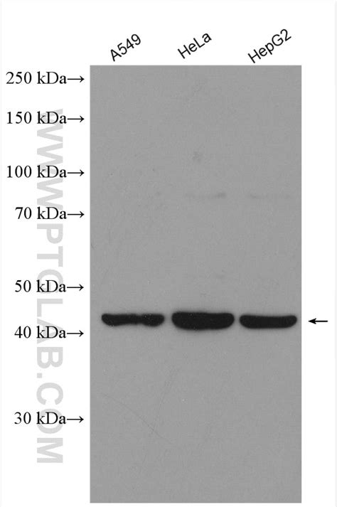 TMEM106B antibody (20995-1-AP) | Proteintech