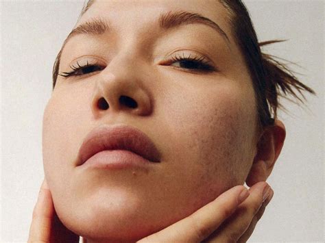 Why Tretinoin Is Considered the "Gold Standard" for Acne—and the Results To Expect