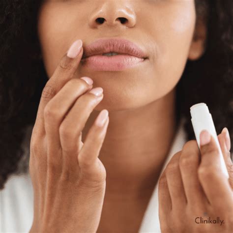 Say Goodbye to Dark Lips: Causes and Treatment Options | Clinikally