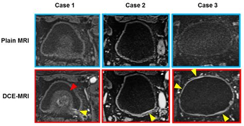 Diagnostics | Special Issue : Urogenital Cancers: Diagnostic ...
