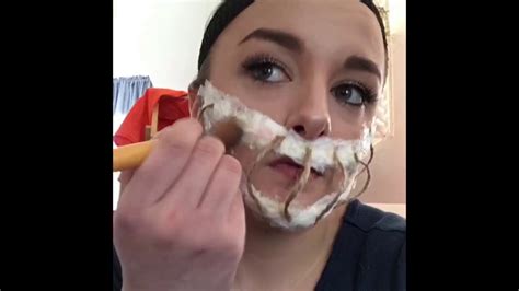 Wired Shut Mouth - YouTube