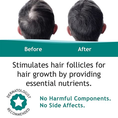 FEG All Natural Hair Growth Spray - Regrow Lost Hair India | Ubuy