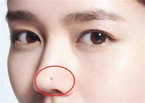 女人鼻子右侧有痣有什么含义？痣长在哪里最好？_华易网