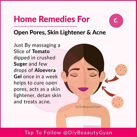 16 home remedies to remove open pores on face and skin permanently – Artofit