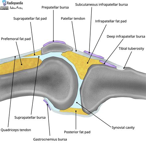 Radiopaedia - Drawing Fat pads and bursae of the knee - English labels | AnatomyTOOL