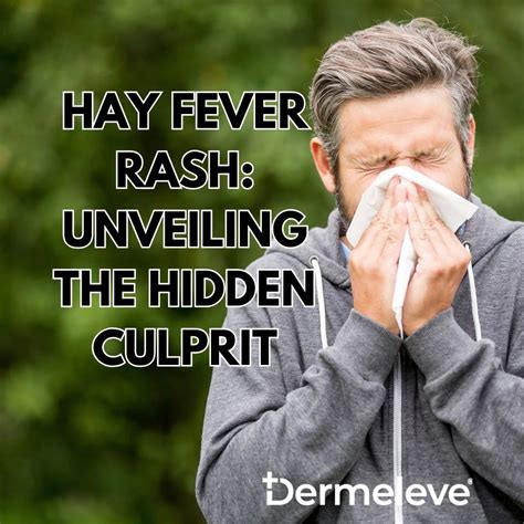 Dermeleve® on LinkedIn: Hay fever rash can be a surprising and irritating addition to the allergy…