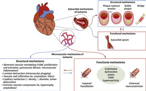 Smoking Macrovascular Disease at Katrina Berg blog