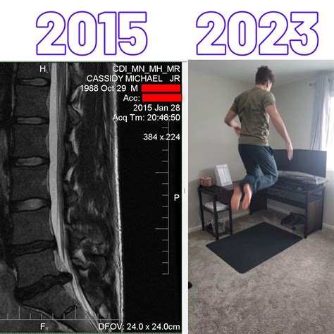 Mri Discovered By Year