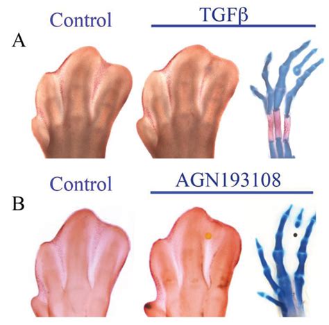Molecular Control of Interdigital Cell Death and Cell Differentiation ...