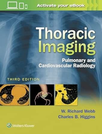 Thoracic Imaging: Pulmonary and Cardiovascular Radiology
